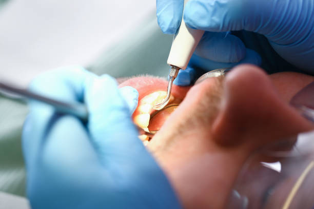 Best Emergency Root Canal Therapy in Bushnell, FL